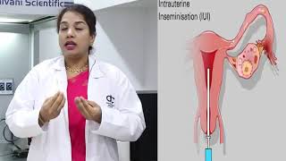 IUI Procedure- Dr.Devamani Pandiyan | Best Infertility Clinic Vellore, Tamilnadu