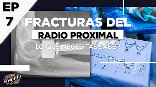 Fracturas del radio proximal