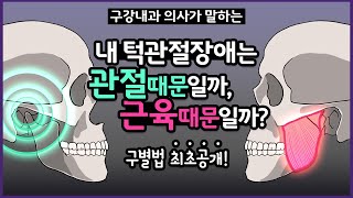 턱관절 장애, 근육통이 원인인지 턱관절 자체 문제인지 구별법