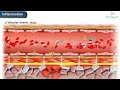 2. vascular events of acute inflammation animation