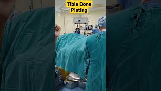 Tibia Bone Plating  | पैर की हड्डी का ऑपरेशन | #mbbsmotivation #mbbs #surgeon #surgery #tibia #bone
