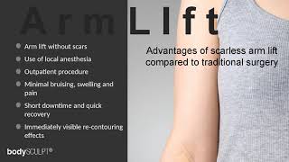 BodyTite Scarless Arm Lift Procedure