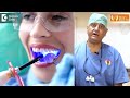 gap in front teeth diastema closure without braces smile dr.manesh chandra sharma doctors circle