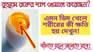 ভু'ল করে এমন ডি'ম খেয়ে ফেলেন নিতো? জানেন খেলে কি হয়? InfoTube Channel.