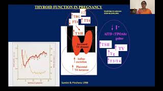 Thyroid Disease in Pregnancy:  Dr  Chandrika N Wijeyaratne