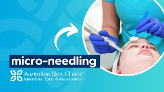 Discover Micro-needling | Australian Skin Clinics