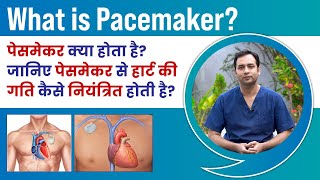 What is Pacemaker? पेसमेकर क्या होता है? जानिए पेसमेकर कैसे काम करता है |Dr Ashar Khan