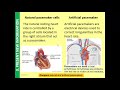 B2 Natural and Artificial Pacemakers