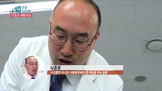 [1분토닥] 뇌졸중재활치료 -원대병원 김민수 교수