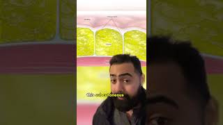 Doctor Explains Why Cellulite Is An Industry Scam!