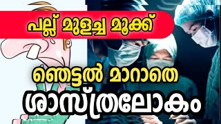 ഞെട്ടൽ മാറാതെ ശാസ്ത്രലോകം അമേരിക്കൻ യുവാവിന് മൂക്കിൽ പല്ല് മുളച്ചു |Teeth erupted in the nose#video