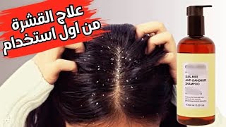 شامبو علاج قشرة الشعر و حكة فروة الرأس من أول أستخدام