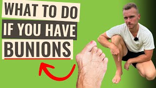 Bunions | How You Can IMPROVE Pain \u0026 Function