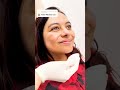 Minha Jornada para Eliminar o Melasma #shorts #skincare #cuidadoscomapele #melasma #rosamosqueta