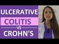 Crohn's Disease vs Ulcerative Colitis Nursing | Crohn's vs Colitis Chart Symptoms, Treatment