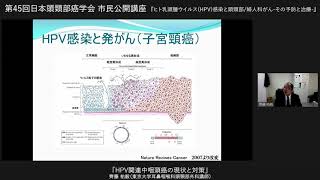 2　第45回日本頭頸部癌学会　市民公開講座　「HPV関連中咽頭癌の現状と対策」