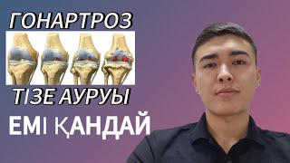 ГОНАРТРОЗ | ТІЗЕ АУРУЫ | СИМПТОМЫ, ЕМІ