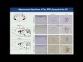 Transmission of misfolded proteins in neurodegenerative disorders (Dr. Virginia Lee}