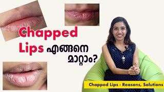 Chapped lips, എങ്ങനെ മാറ്റാം? - Reasons, Solutions