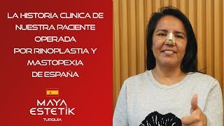 La historia clinica de nuestra paciente operada por rinoplastia y mastopexia de españa