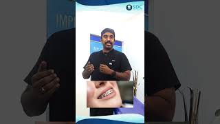 Can Invisalign fix crowded teeth? | Invisalign நெரிசலான பற்களை சரிசெய்ய முடியுமா? | Dr.MKP