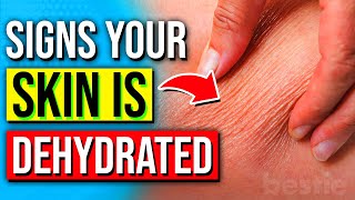 7 Signs Your Skin Is DEHYDRATED & How To Revive It Naturally