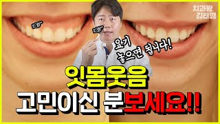 웃을 때 잇몸웃음 되는게 고민이신분들 | 거미스마일 보톡스와 잇몸성형에 대한 모든 것