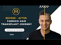 Watch The Hair Transformation - Fabrico Before & After