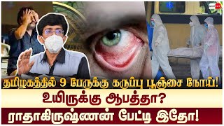 தமிழகத்தில் பரவும் கருப்பு பூஞ்சை நோய்?  ராதாகிருஷ்ணன் பேட்டி இதோ! Health Secretary