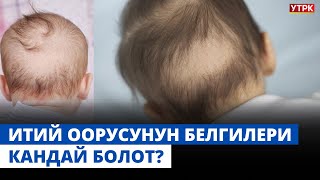 Итий оорусунун белгилери кандай болот? | 