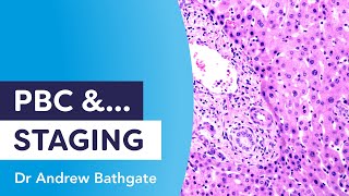 PBC and Staging | Dr Andrew Bathgate