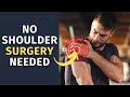 How to TREAT a Rotator Cuff Injury WITHOUT Surgery