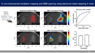 Batts - High Resolution CT-based Preplanning for Transcranial BBB Opening (Poster) (2020)