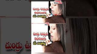 చుండ్రు ఉన్నపుడు సాధారణం గా చేసే పొరపాట్లు | The 5 Mistakes To Avoid For Dandruff Sufferers #Short