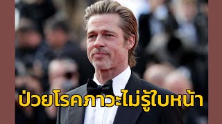 แบรด พิตต์ เชื่อว่าตนเองป่วยเป็นโรคภาวะไม่รู้ใบหน้า ส่งผลให้ไม่อยากเข้าสังคม