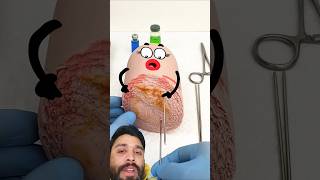 Operation🔪👨‍🔬 of A sausage🥖 #3d #cartoon #comedy #funny #shorts #shortsvideo #reaction #funnyvideos