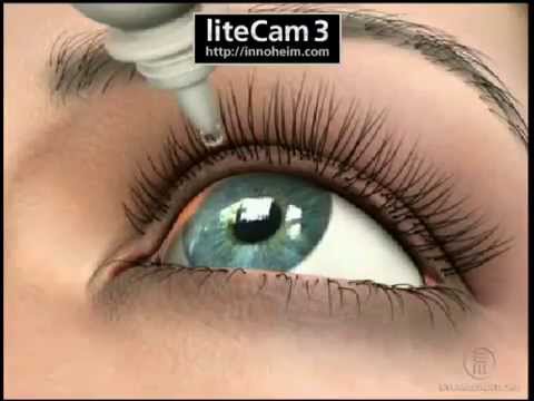 Dilated examination Dilated examination