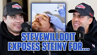 Stevewilldoit EXPOSES Steiny For Botox!