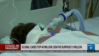 Global COVID-19 cases top 40 million; deaths surpass 1.1 million