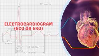 Apa Itu Elektrokardiogram (EKG) ?