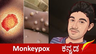 Monkey Pox Simplified in Kannada | Bhoogola | Kannada