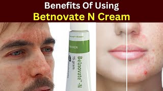 Betnovate n cream Review | betnovate n cream 20 grams | Benefits | how to use