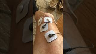 Electric Shock Therapy