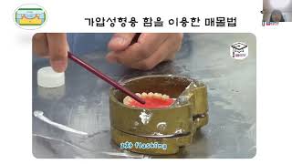 납의치에서 수지의치 매몰 과정