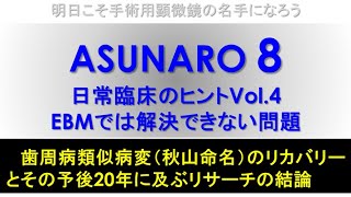 Vol.4 セメント質剝離完全攻略 #顕微鏡歯科 #マイクロ #顕微鏡治療 #ペリオ #歯周病 #歯周外科 #ペリオドンタルマイクロサージェリー #再生療法