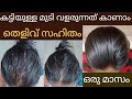 മാസങ്ങൾക്കുള്ളിൽ Thick Hair growth||മുടി ഇല്ലാത്ത തലമണ്ടയിൽ മുടി വരുന്നത് കാണാം😱