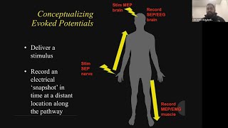 Protocol for Neuromonitoring Changes : Case Conference Jan 24, 2022