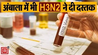 Ambala में भी इन्फ्लूएंजा वायरस H3N2 ने दी दस्तक, पॉजिटिव आई नर्स की रिपोर्ट