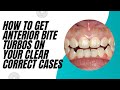 How to get Anterior Bite Turbos on your Clear Correct Cases