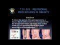 Overview of Endolumenal Procedures - Do They Really Work? - Jacques M. Himpens, M.D.